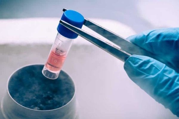 精子冷冻