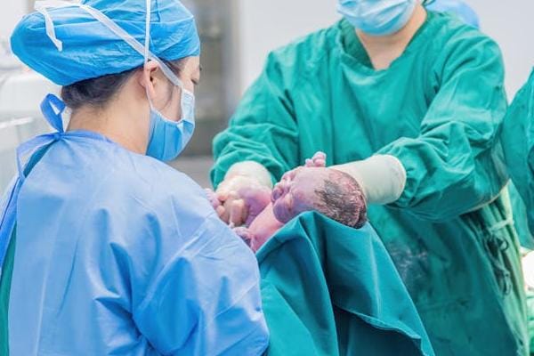 代理孕母的剖腹产切口类型